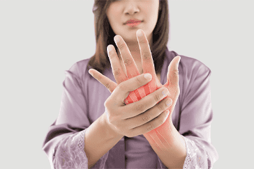 Rheumatoid Arthritis